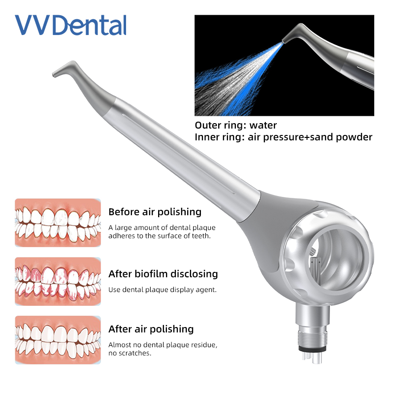 Pistolet de sablage dentaire V - Teeth Whitening China avis et prix