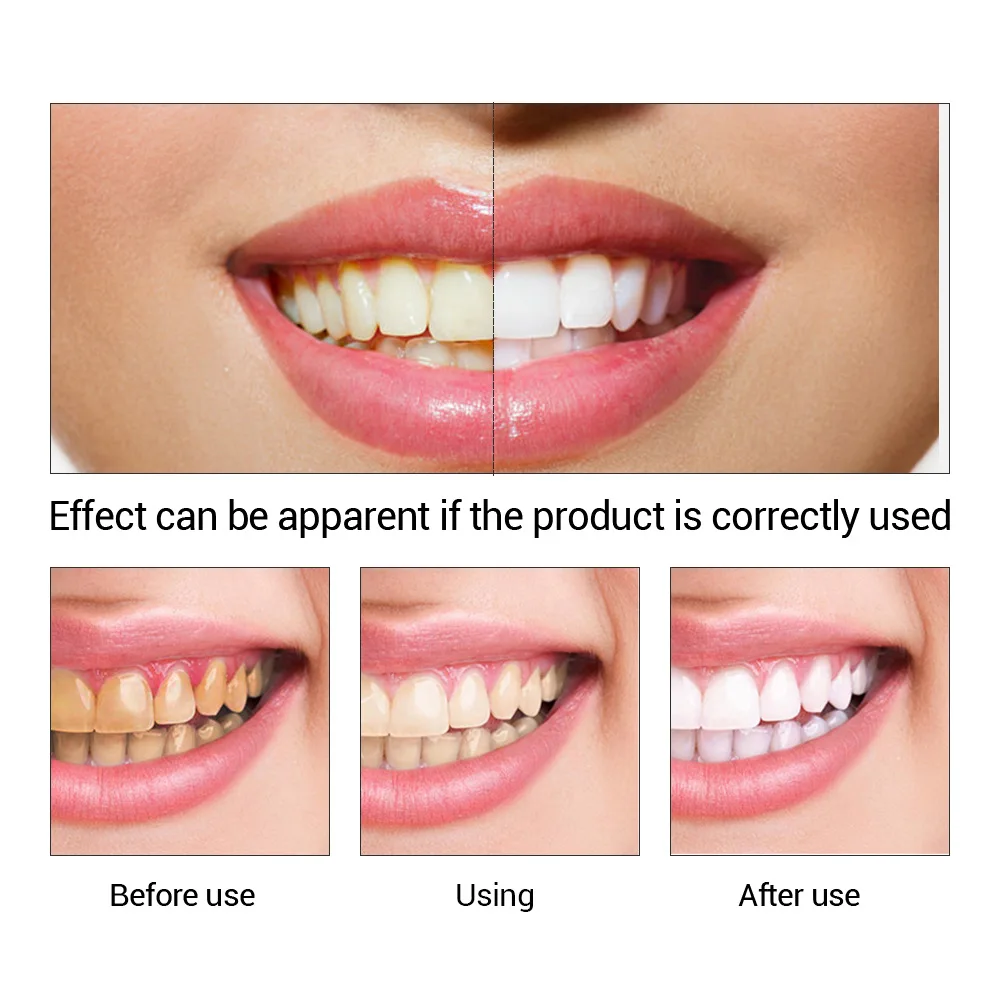 FTEENPLY poudre d'essence de b - Teeth Whitening China avis et prix