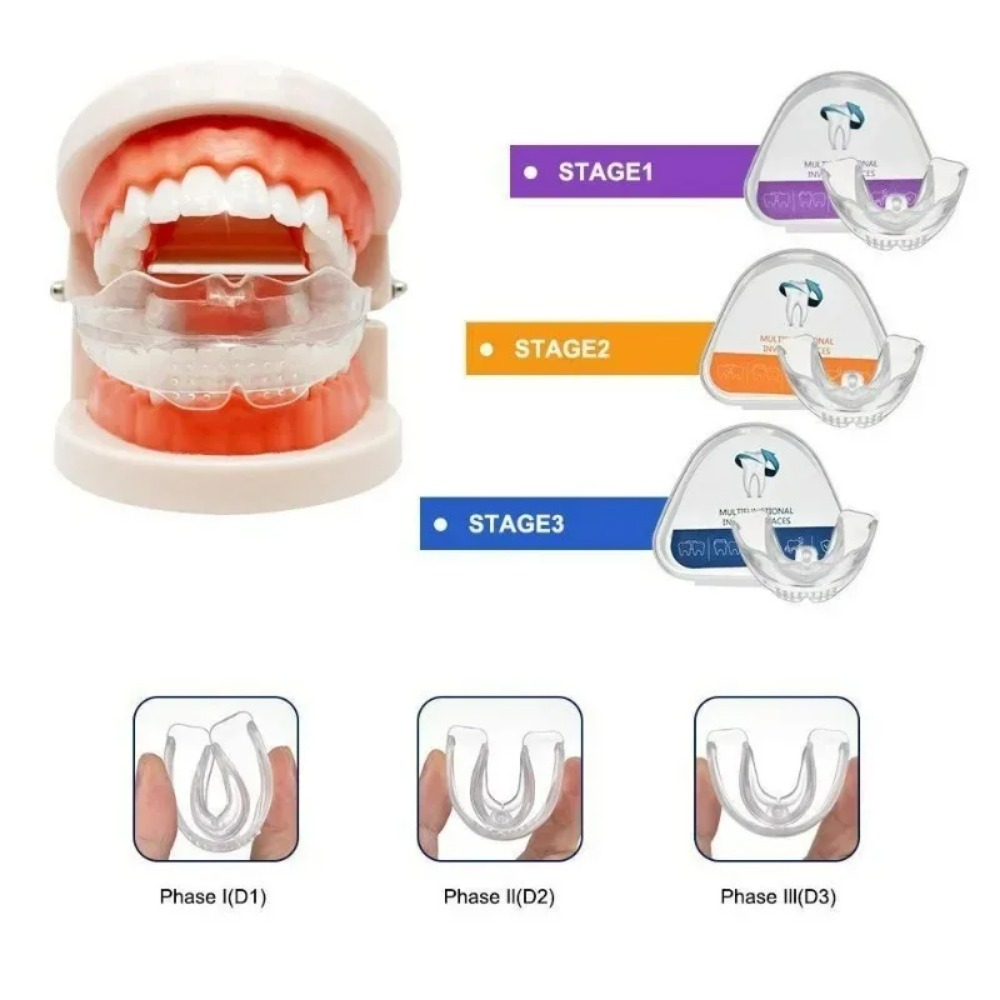 Appareil orthodontique de redr - Teeth Whitening For Braces avis et prix
