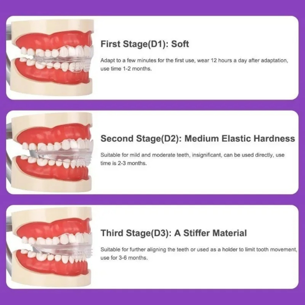 Appareil orthodontique de redr - Teeth Whitening For Braces avis et prix